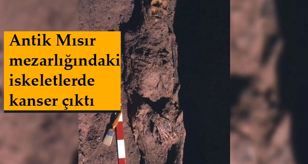 Antik Mısır mezarlığındaki iskeletlerde kanser çıktı